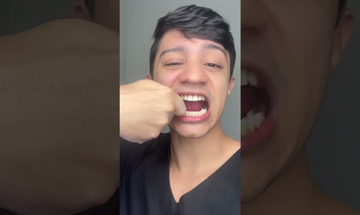 Meus dentes entortaram e a contenção não funciona mais! 😭🦷 #shorts #ortodontia